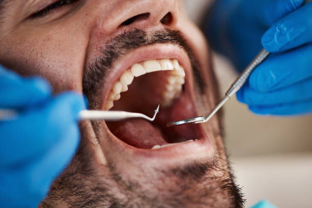 Best Walk-In Emergency Dentist in Montana City, MT